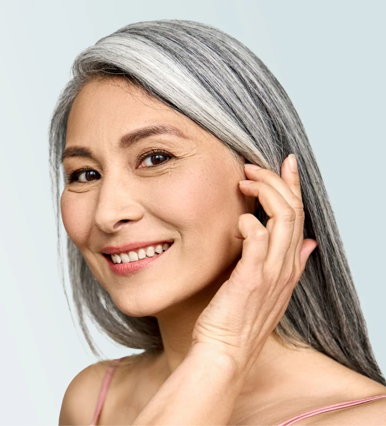 Woman with Eyelid Surgery